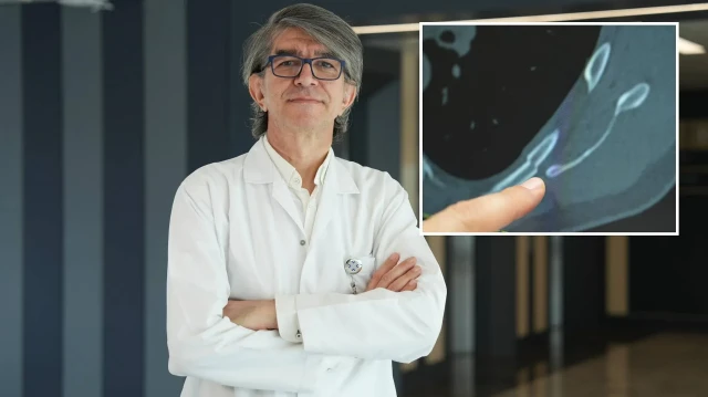 uzman isim uyardi oksururken kaburgalariniz kirilabilir IDCNmsMK