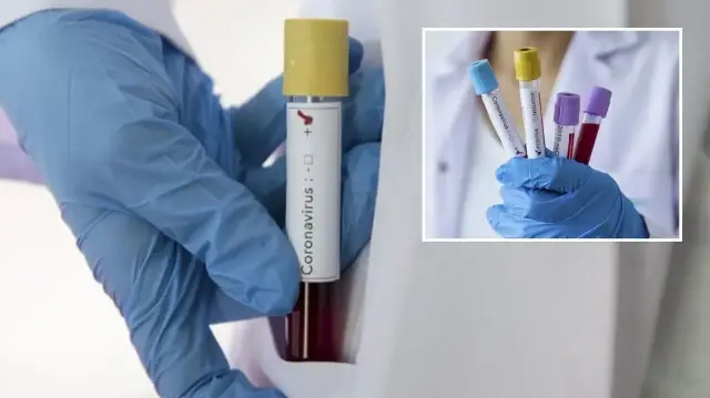 zayiflar kovid 19u daha agir geciriyor bi2HyziO.webp